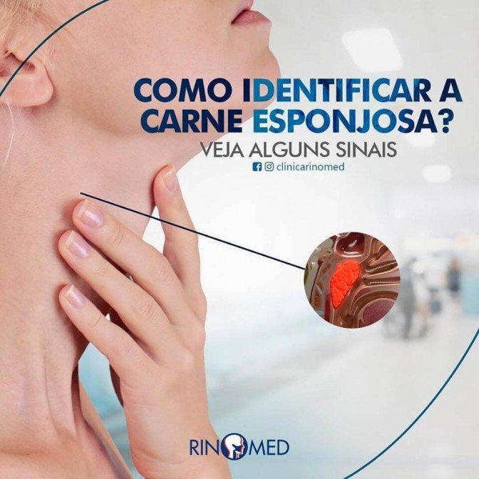 Marque um atendimento com a equipe da RINOMED e se certifique de que